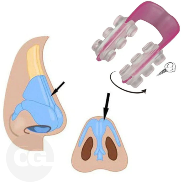 Facial Beauty - Nose Shaper - Image 3